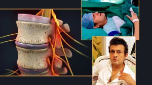 স্নায়ুতে যেন ধারালো চিমটি, গলার কাছে যন্ত্রণা! কোন সমস্যায় ভুগছিলেন সোনু নিগম?